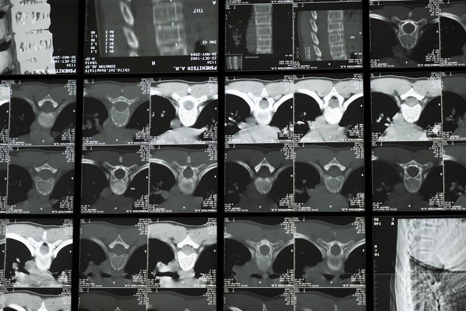 porous titanium lattice bone implant osseointegration CT scan comparison